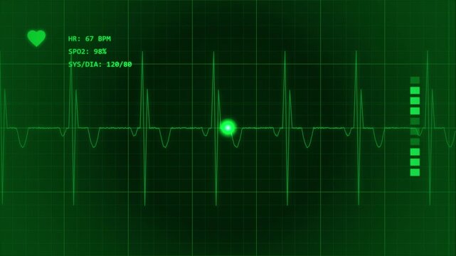 Digital heart rate monitor display with ecg grid and green pulsing indicator