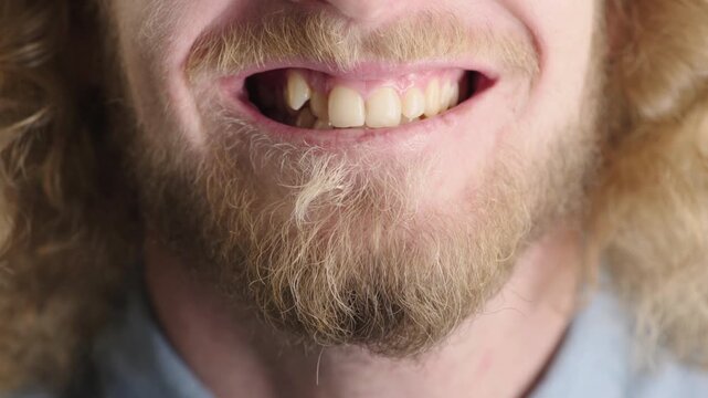 Dental hygiene, smile and man with crooked teeth, orthodontics and mouth with gum disease or plaque. Gingivitis, cavity or person with beard, oral care or closeup of root canal treatment for health