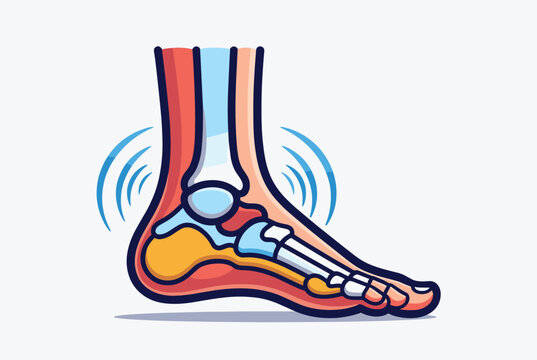 Anatomical illustration of the human foot and ankle highlighting skeletal structure and potential joint injury or inflammation.