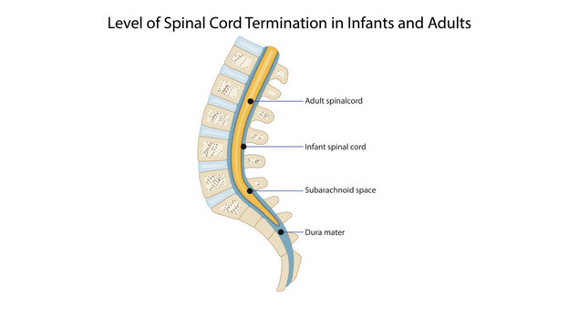 Level of Spinal Cord Termination in Infants and Adults, comparing the level of spinal cord termination in infants and adults, highlighting developmental anatomical differences.