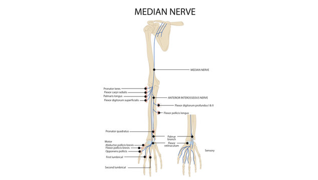 Median Nerve Anatomy and Clinical Entrapment Sites, median nerve showing its course through the upper limb, major branches, sensory distribution, and common sites of nerve compression.