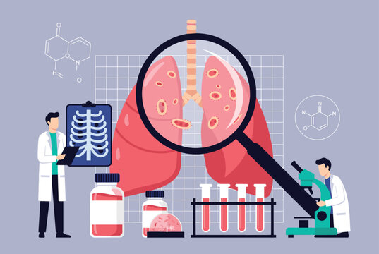 Conceptual medical illustration of lung health showing scientists examining human lungs with a magnifying glass, microscope, and lab results.