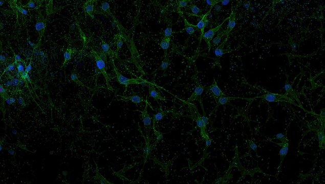 Laboratory stained brain astrocytes glial cells with GFAP green fluorescence and nuclear DAPI blue marking with copy space