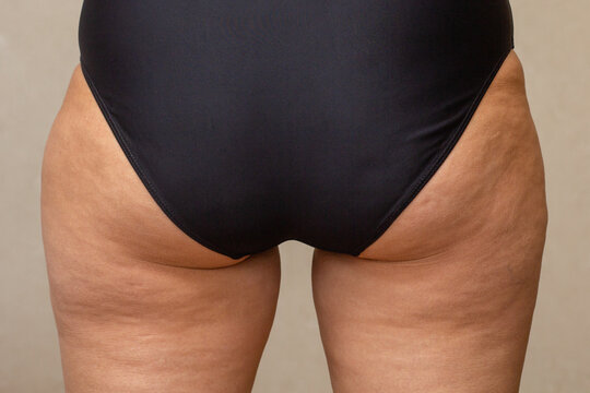 An unfiltered and unretouched close-up of a woman's lower body in a black swimsuit, showcasing the natural skin texture with visible signs of cellulite.