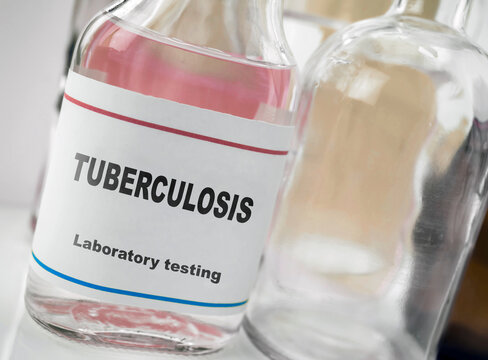 Tuberculosis laboratory research, conceptual image