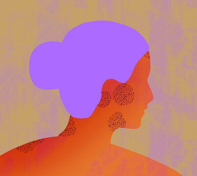 Woman with textured patches of skin illustrating skin conditions dermatological health disorders