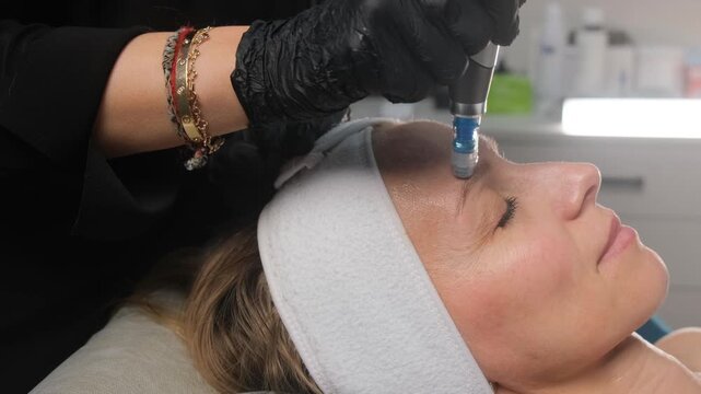 Professional cosmetologist making a microneedling procedure on the forehead of a relaxed female client