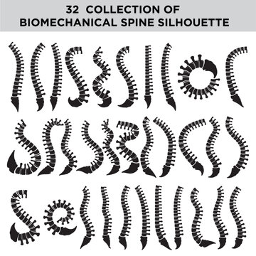 Human Spine Curvature Silhouettes Set, Spinal Column Deformity and Scoliosis Vector Icons
