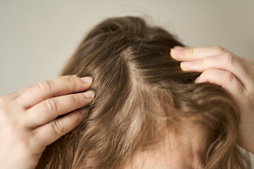 Naklejka premium Woman Examining Scalp Parting With Fingers To Reveal Thinning Roots In Indoor Neutral Setting, Closeup Of Brown Hair And Hands Near Forehead.