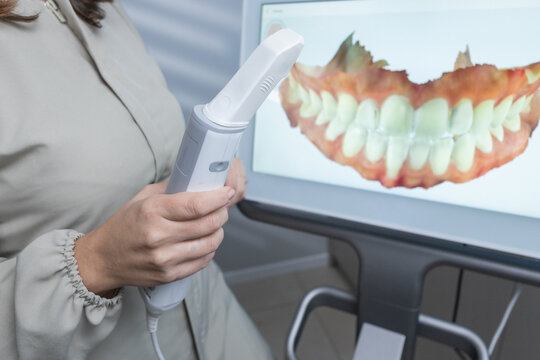 Las manos de dentistas escaneando sonrisa en Itero