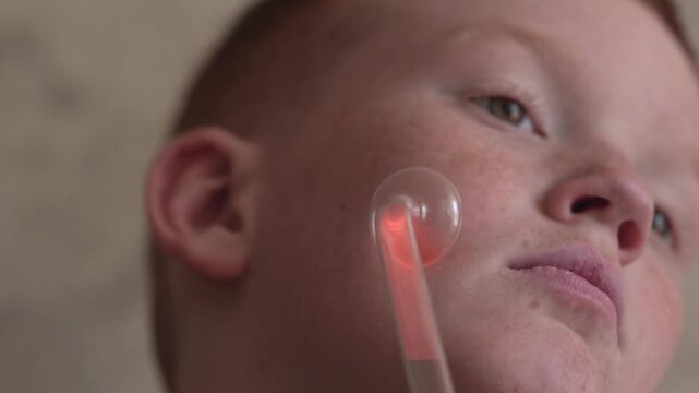 A teenager uses a Darsonval device on their face. Professional skincare at home. Teenage skin problems during hormonal changes. High quality FullHD footage
