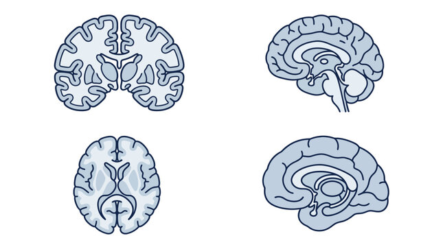 Medical diagrams showing human brain cross sections
