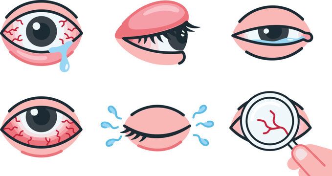 Ophthalmology and Eye Disease Icon Set with Red Bloodshot Eyes, Watery Crying Eye, Swollen Eyelid, Irritation, Tears, and Magnifying Glass Examination Vector