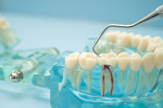 Dental teeth model with dentist tool for dentistry.