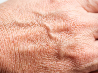 Fototapeta premium Close up of wrinkled aged skin texture with prominent veins elderly