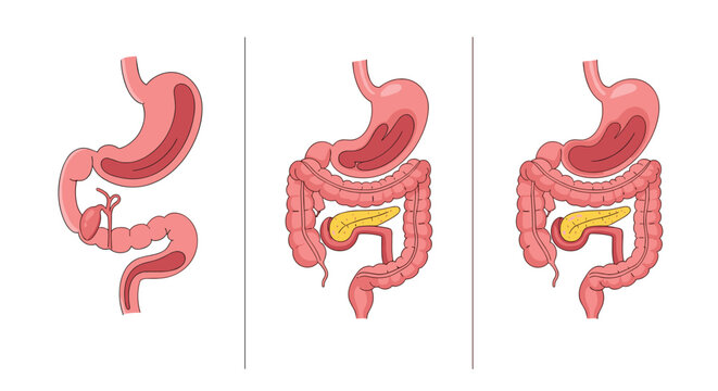 Comparison diagram of the human digestive system including the stomach pancreas and intestines in three different views.