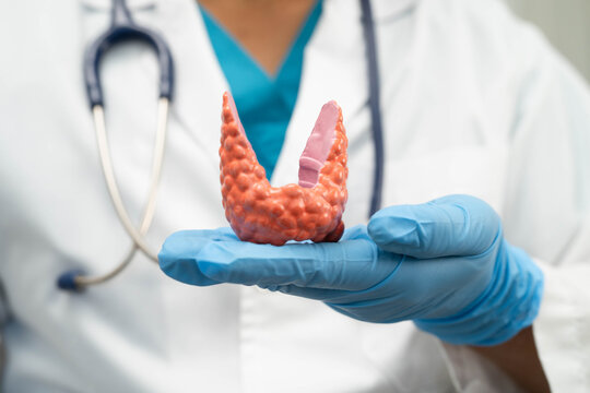 Hyperthyroidism, Overactive Thyroid, Thyroid Lymphoma, Asian doctor with thyroid gland human anatomy model in hospital.