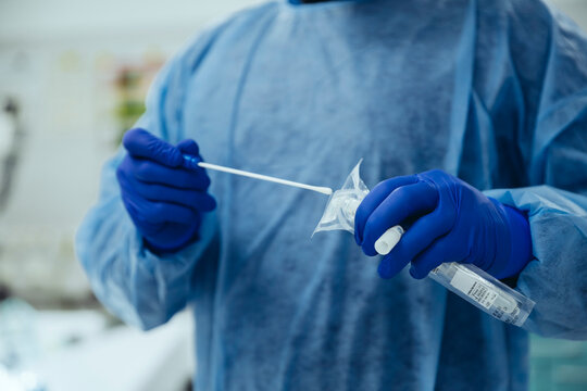 Close-up of emergeny doctor putting a swab into a tube in hospital