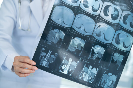 doctor radiologic looks abdomen abdominal x-ray image film shows liver, colon,spleen, small intestine, bladder.