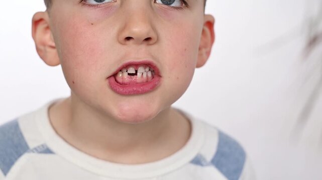6 years old boy shows hole where his baby tooth fell out. Teething in children. Baby teeth are replaced by permanent ones. Pediatric dentistry, teeth replacement