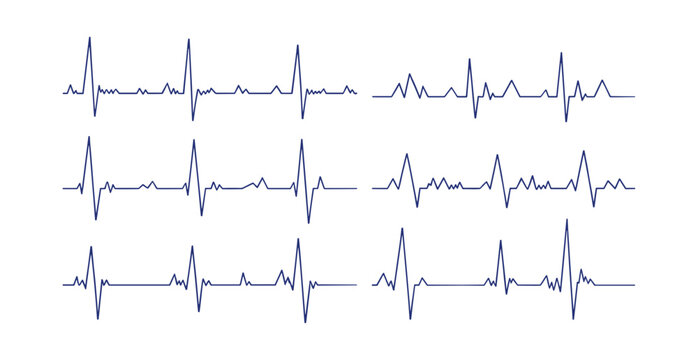 Electrocardiogram Readings: A collection of electrocardiogram (ECG) readings showcasing variations in heart rhythm and electrical activity, displayed as a series of blue lines on a white background.