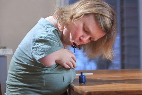 Woman with TAR Syndrome painting her nails at home