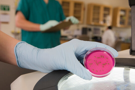 Scientist analyzing bacterial growth in a sample