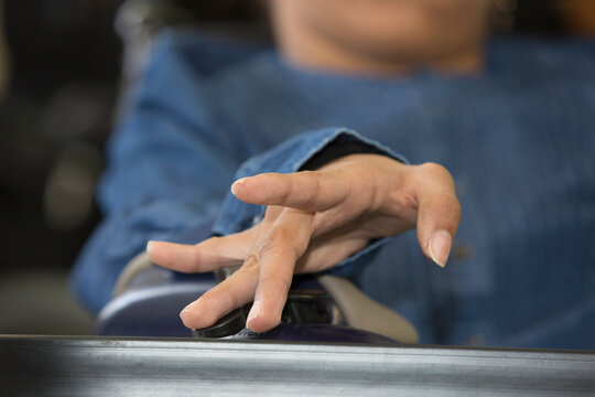 Hand of teen with Spastic Dystonic Cerebral Palsy at school