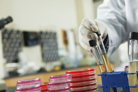 Scientist analyzing bacterial colonies