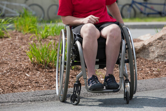 Woman with degenerative hip in a wheelchair