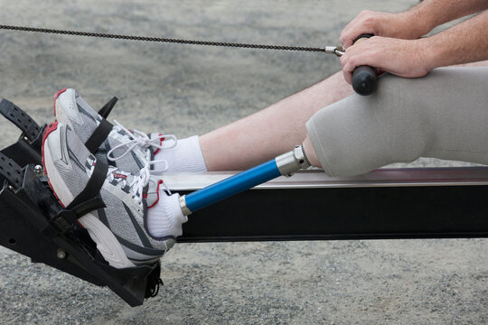 Man with a prosthetic leg exercising on an exercise bike