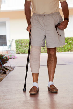 Senior man with bandage on his leg standing with the help of a cane