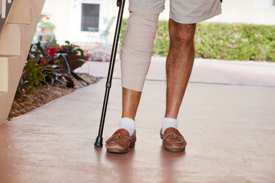 Senior man with bandage on his leg standing with the help of a cane