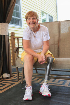Woman with a prosthetic leg sitting on her porch