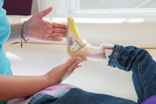 Mother putting leg brace on small daughter with Cerebral Palsy