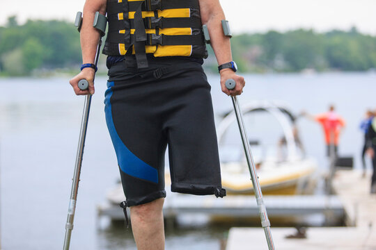 Woman with one leg about to go waterskiing