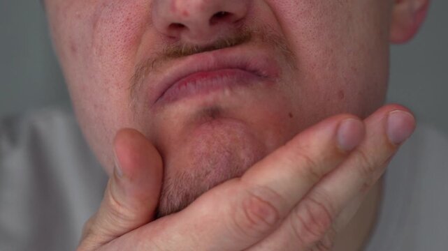 Hair on a man's cheeks.
A bearded guy touches his face with his hands.