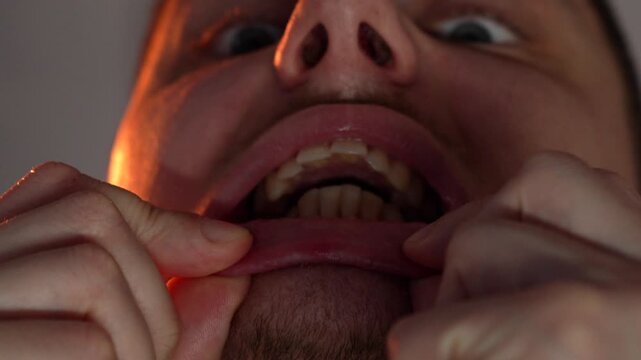 A close-up of a man's crooked teeth.
Uneven bite when clenching the jaw.