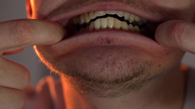 A man with bad teeth and a bite problem.
Bite correction for a beautiful smile