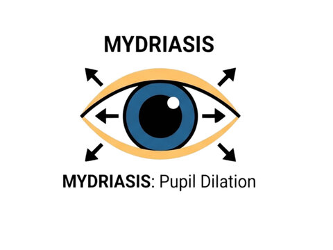 Mydriasis diagram demonstrates the physiological process of pupil dilation in the human eye which allows more light to enter and is often observed during eye examinations or autonomic responses.