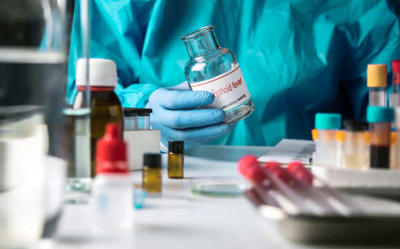 A scientist holds a test vial containing a typhoid fever sample in a laboratory; conceptual image