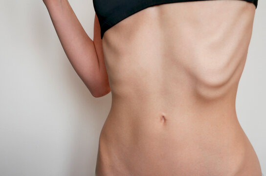 close up of a caucasian woman's stomach with ribs showing on a white background