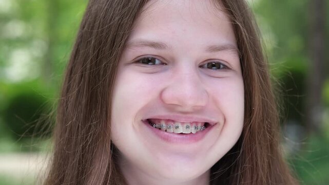 Close up portrait of caucasian happy teen girl smiling showing teeth with braces. Positive teenager outdoors looking at camera
