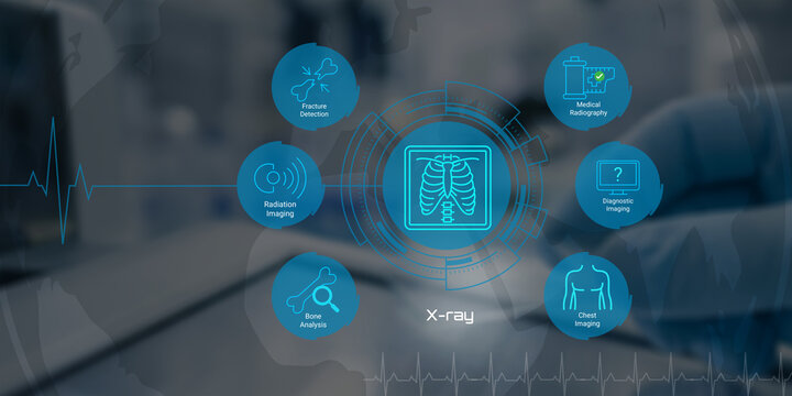 Modern medical xray technology applications for fracture detection chest imaging and diagnostic radiography