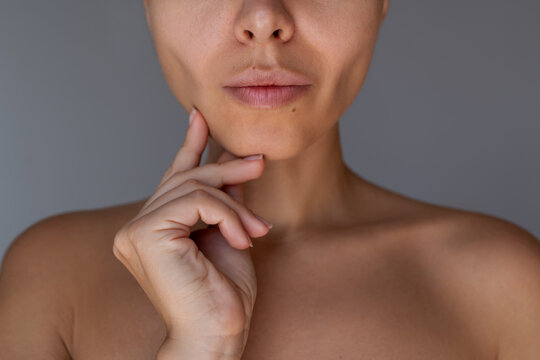 Close up of young woman's lower face showing sculpted jawline and slimmer cheeks after buccal fat removal surgery. Aesthetic plastic surgery result concept