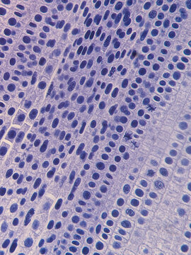 Allium cepa Root Tip Cells Showing Chromosomes During Telophase Stage of Mito