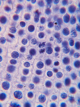 Allium cepa Root Tip Cells Showing Chromosomes During Telophase Stage of Mito