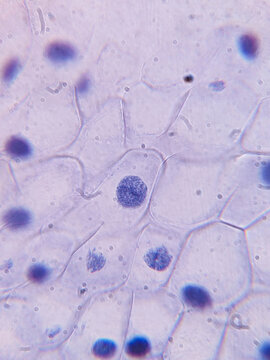 Allium cepa Root Tip Cells Showing Chromosomes During Telophase Stage of Mito