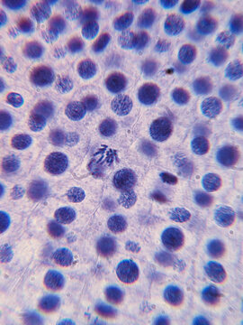 Allium cepa Root Tip Cells Showing Chromosomes During Telophase Stage of Mito