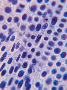 Allium cepa Root Tip Cells Showing Chromosomes During Telophase Stage of Mito